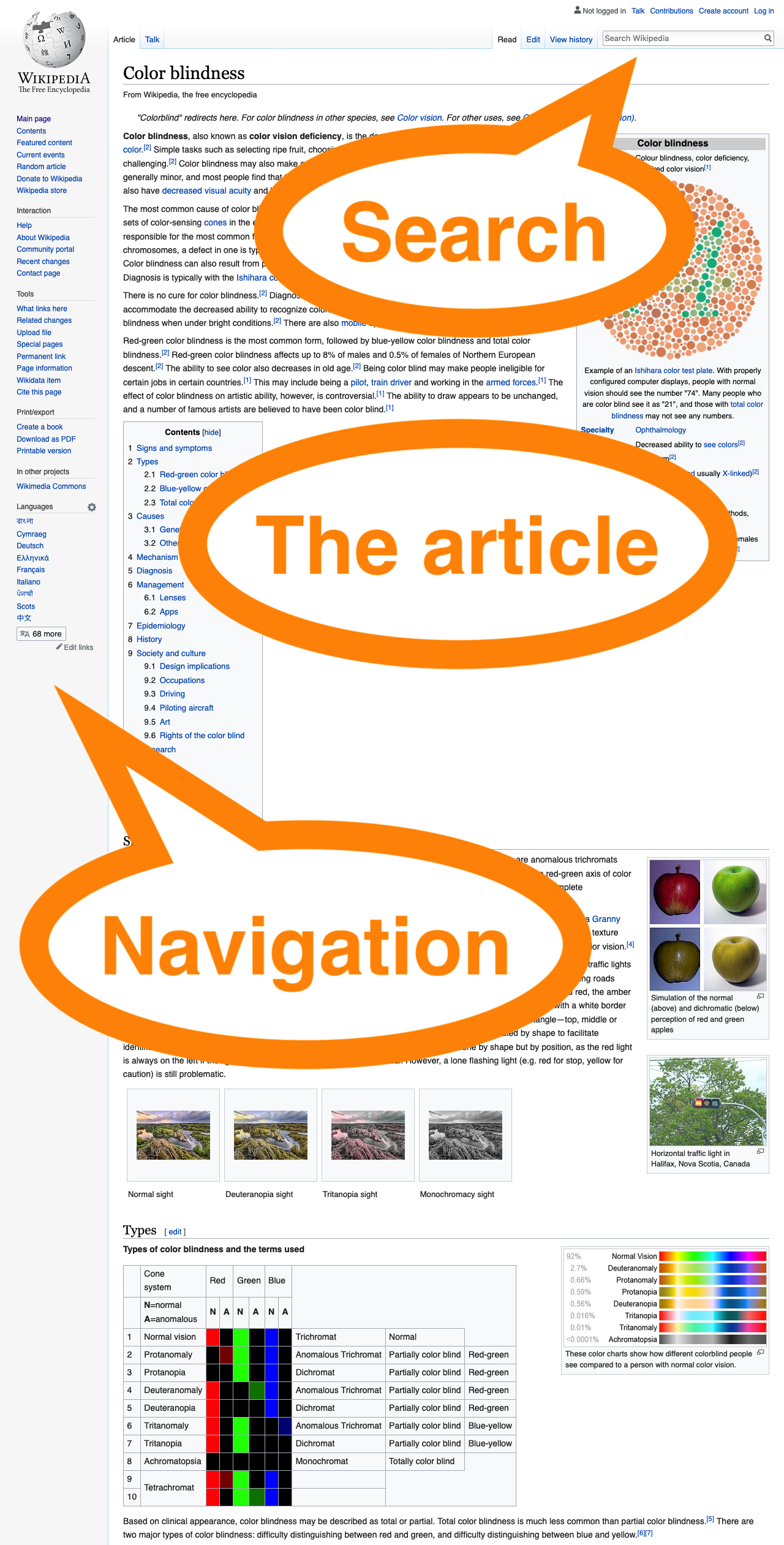 Wikipedia article on colour perception deficit with three main landmark regions called out